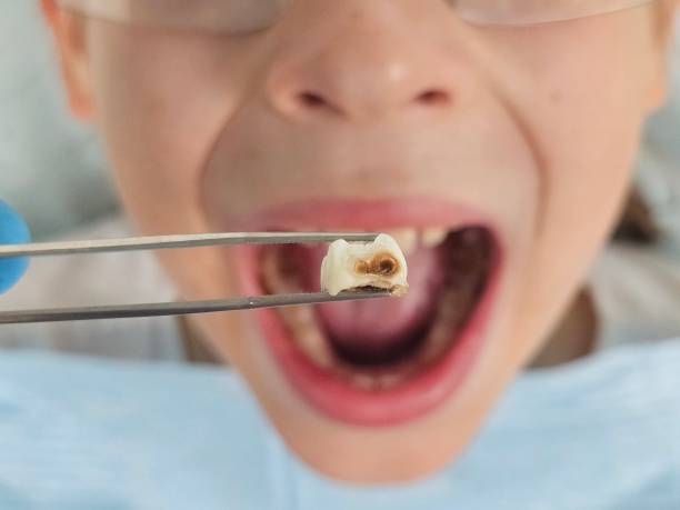 Best Pediatric Emergency Dentist in Nettleton, MS